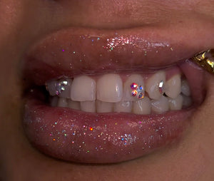 Mini Tooth Gem Freestyle Set DEPOSIT