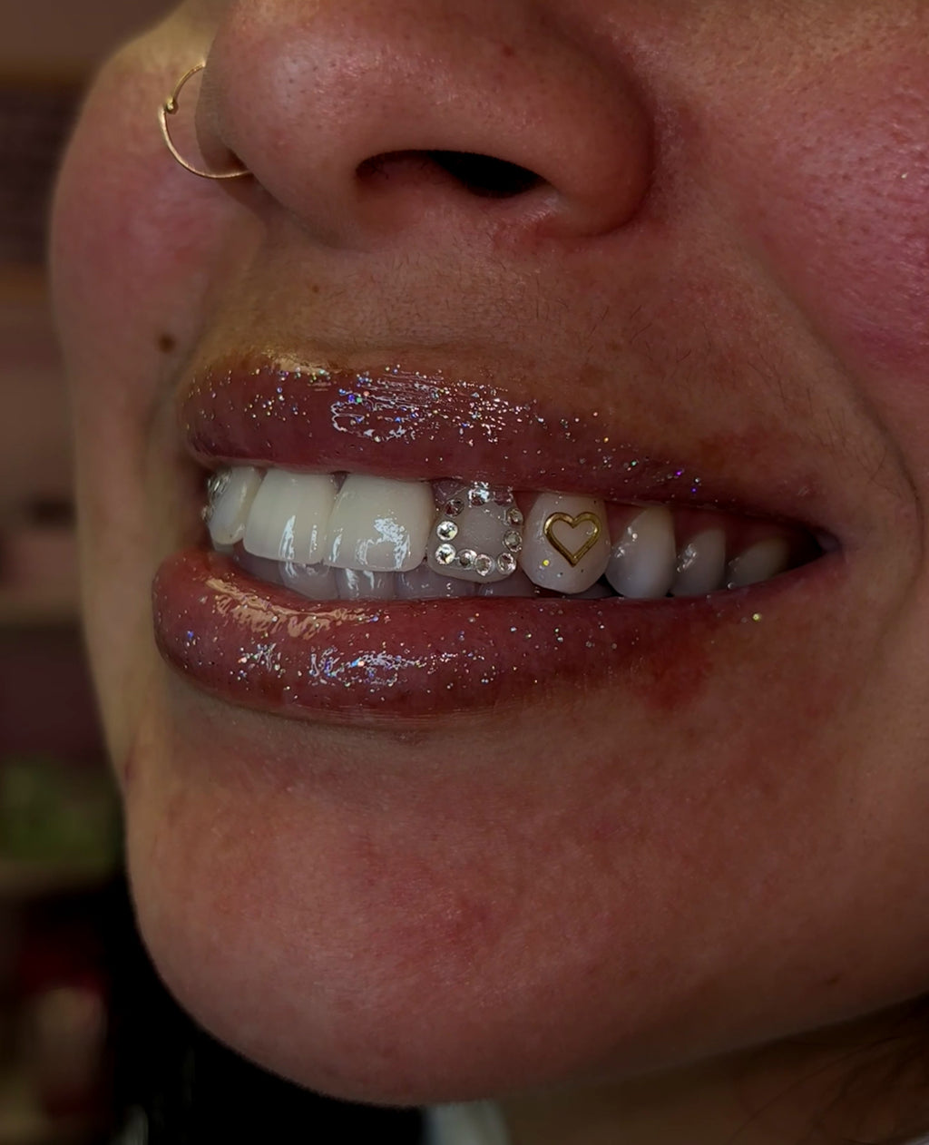 18 Karat Gold Tooth Decal Reservation DEPOSIT*