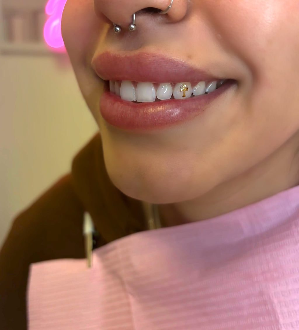 18 Karat Gold Tooth Decal Reservation DEPOSIT*
