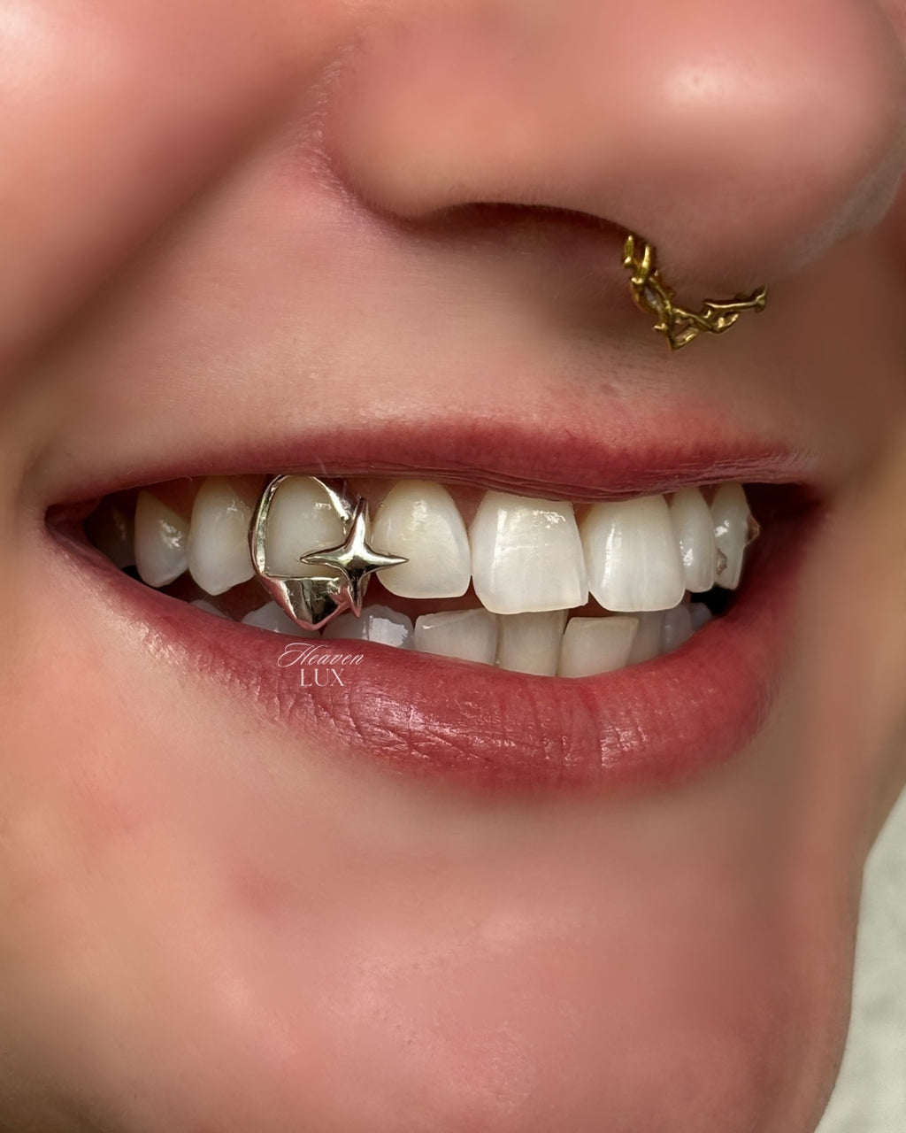Grillz Consultation/Impression • Payment plans available