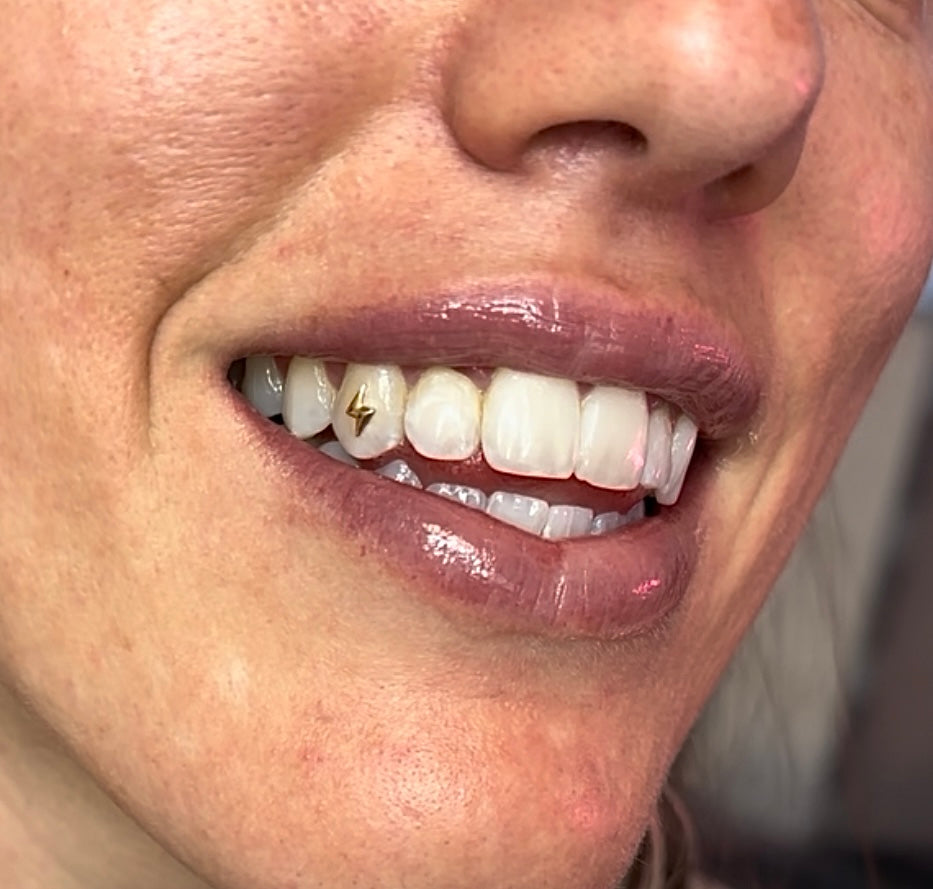 18 Karat Gold Tooth Decal Reservation DEPOSIT*