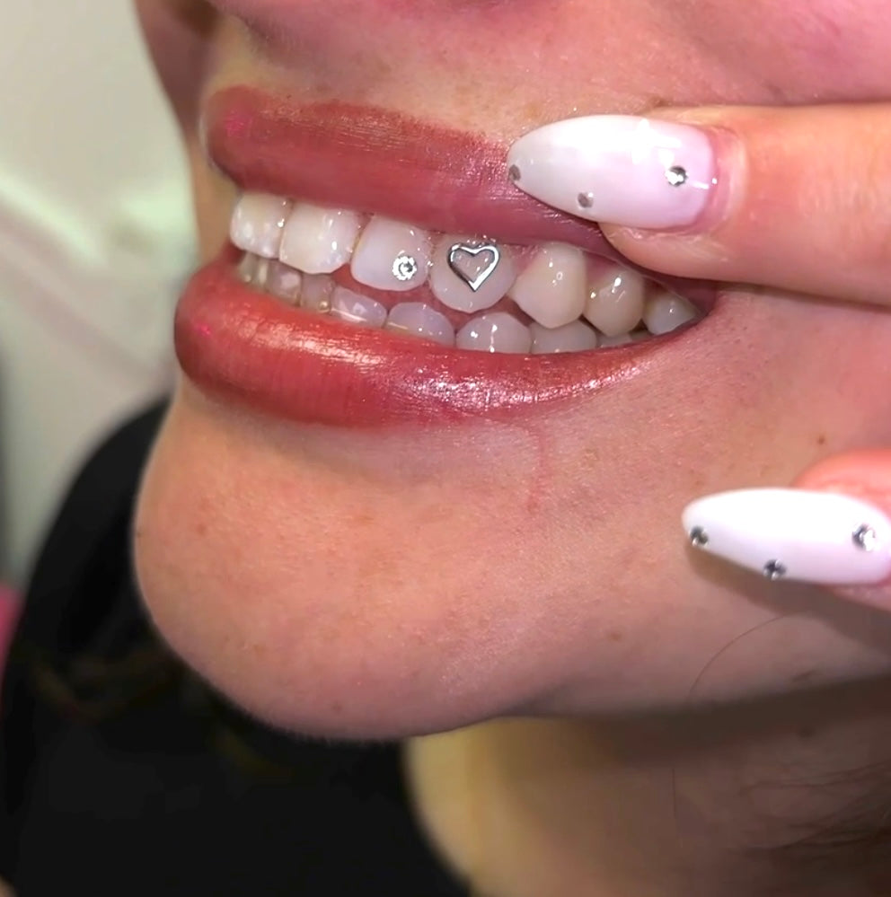 18 Karat Gold Tooth Decal Reservation DEPOSIT*